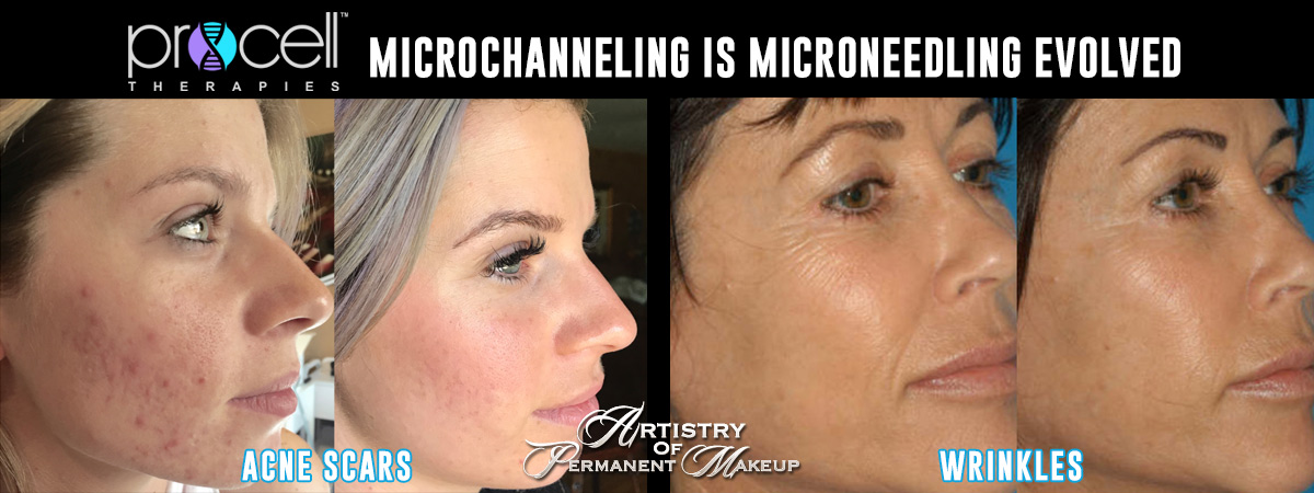 ProCell Therapies in Mission Viejo by Artistry Of Permanent Makeup